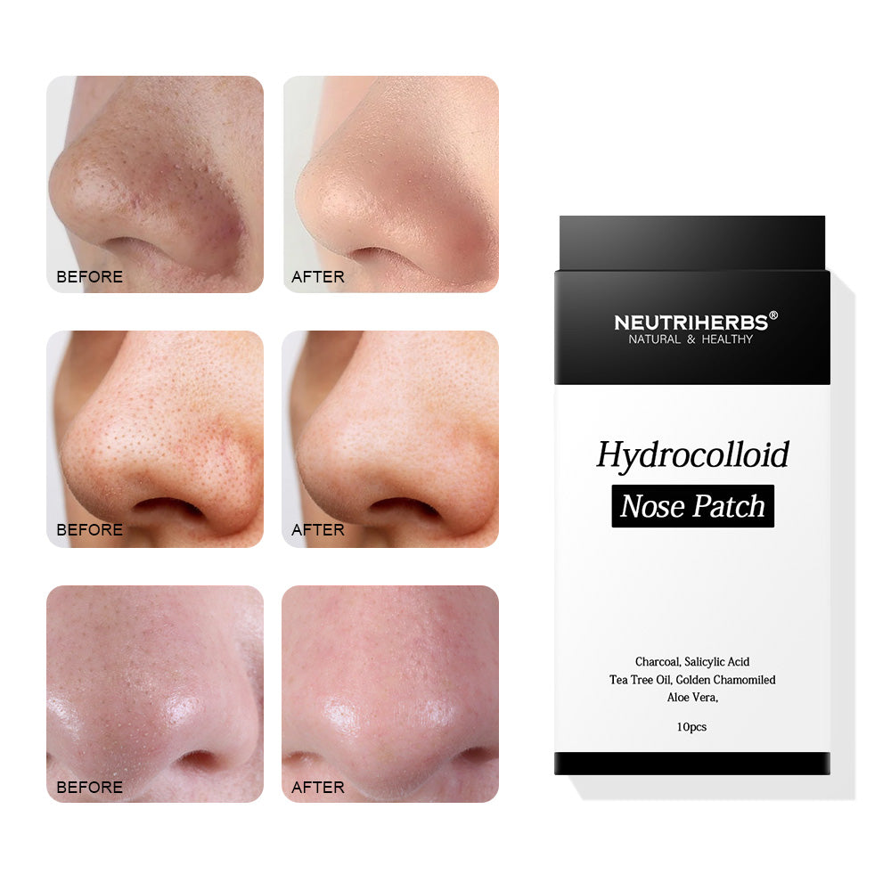 private label blackhead zero 2 step nose patch