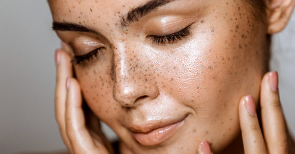 Taking care of Oily skin