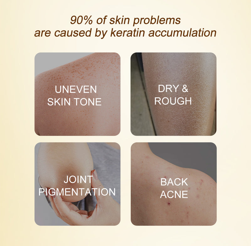 90% of skin problems are caused by keratin accumulation