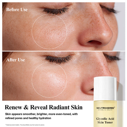 Private Label & Wholesale Glycolic Acid Toner for Gentle Exfoliation, Brightening & Pore Refining