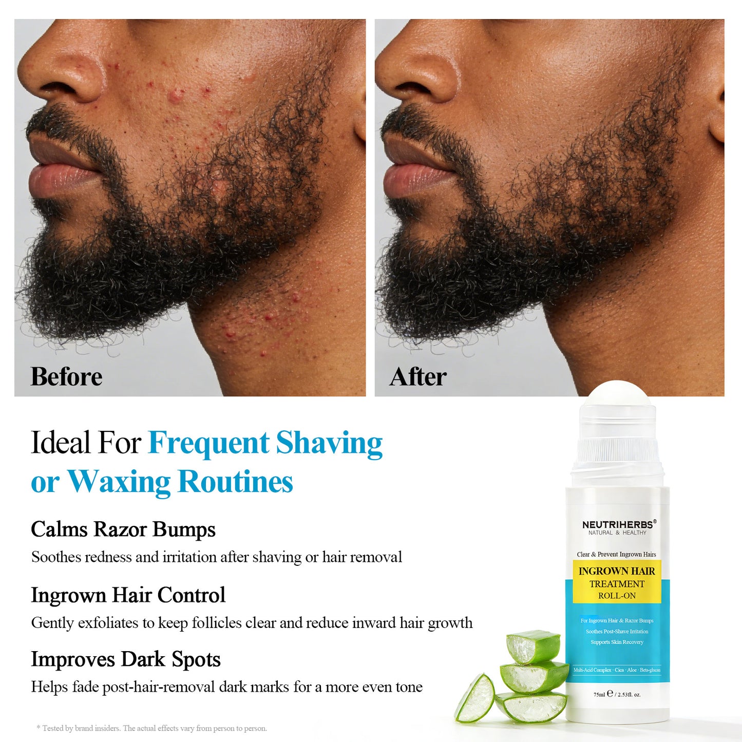 Private Label & Wholesale Clear & Ingrown Hair Treatment Roll-On For Ingrown Hair & Razor Bumps