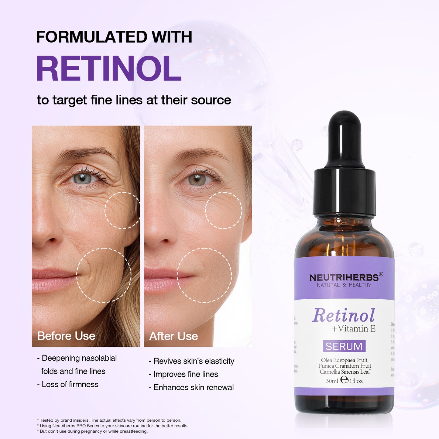 Private Label Retinol Serum For Wrinkles and Acne-prone Skin