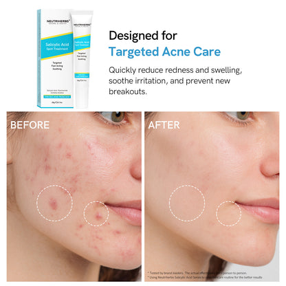 Private Label Salicylic Acid Spot Treatment Gel For Oily, Acne-Prone Skin