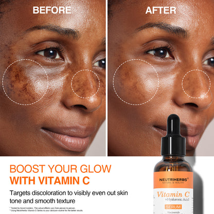 Private Label Vitamin C Serum for Anti-Aging