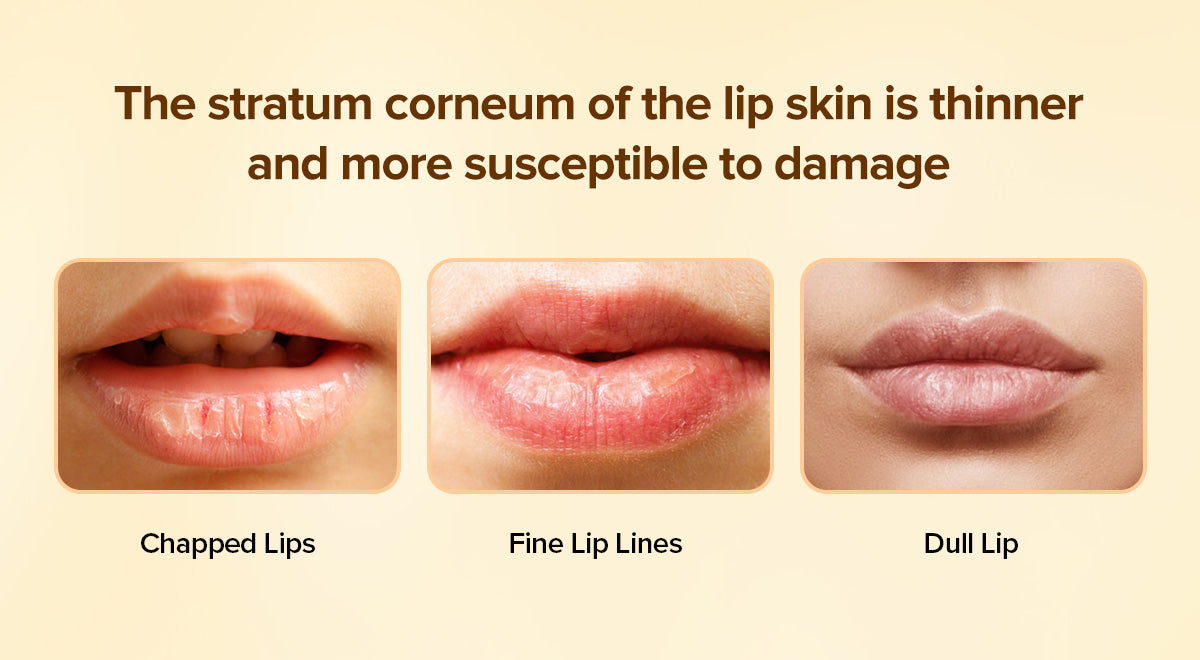 Private Label & Wholesale Vitamin C Lip Smooth Treatment Cream Amarrie Cosmetics Private Label & Wholesale Vitamin C Lip Smooth Treatment Cream Amarrie Cosmetics