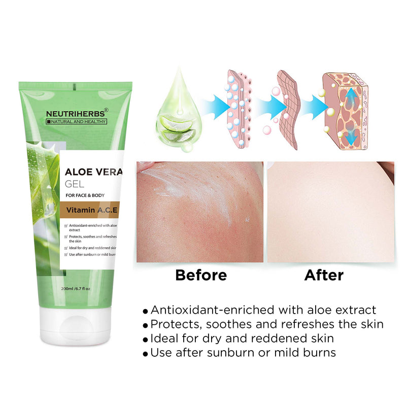 Neutriherbs Aloe Vera Gel with Vitamin A, C, E- relieve minor burns, insect bites, chafing and itching