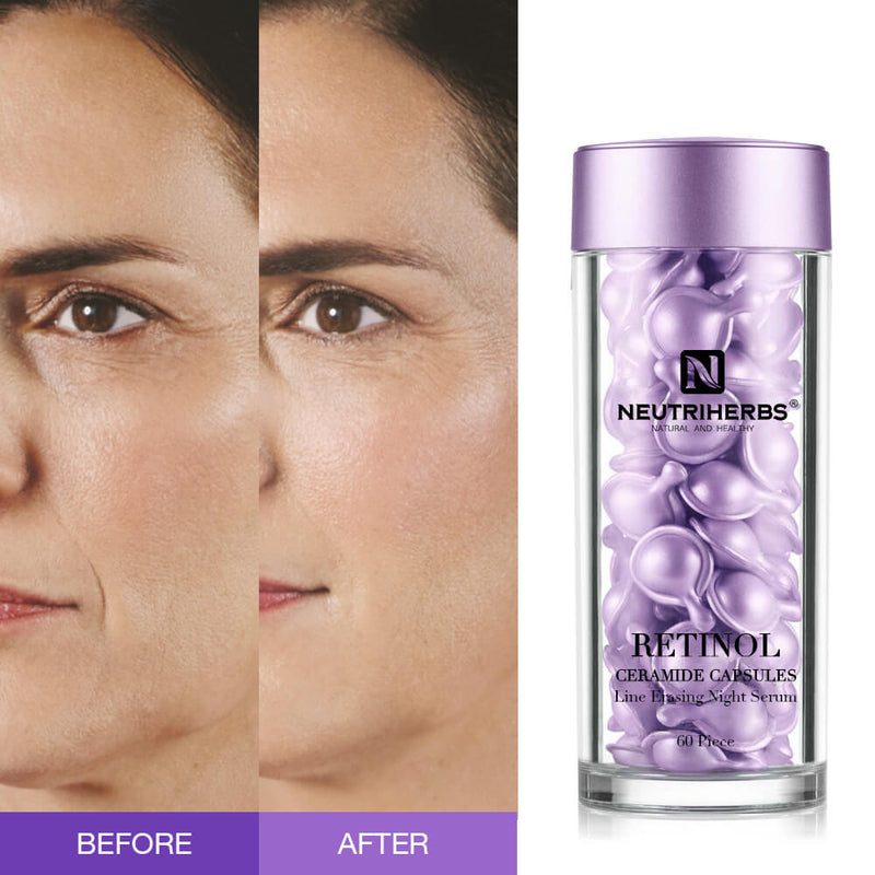 Neutriherbs Retinol Capsules For Acne
