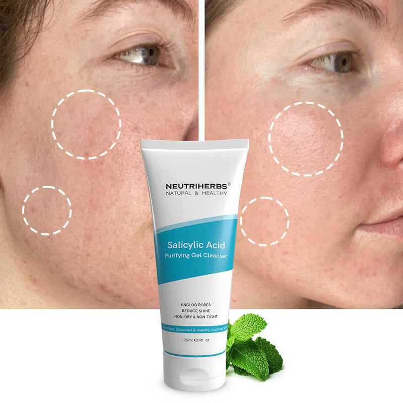 salicylic acid cleanser