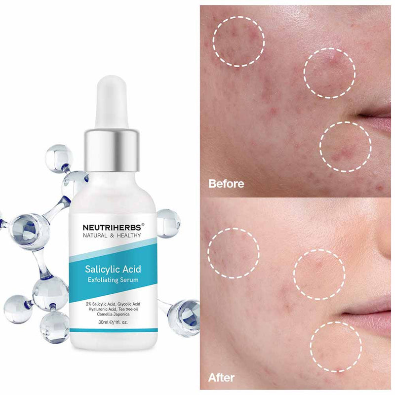 best salicylic acid serum