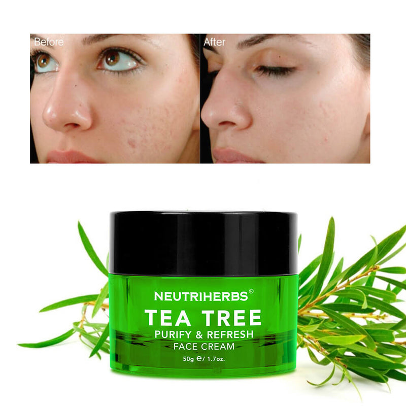 Private Label Best Tea Tree Oil Cream For Acne