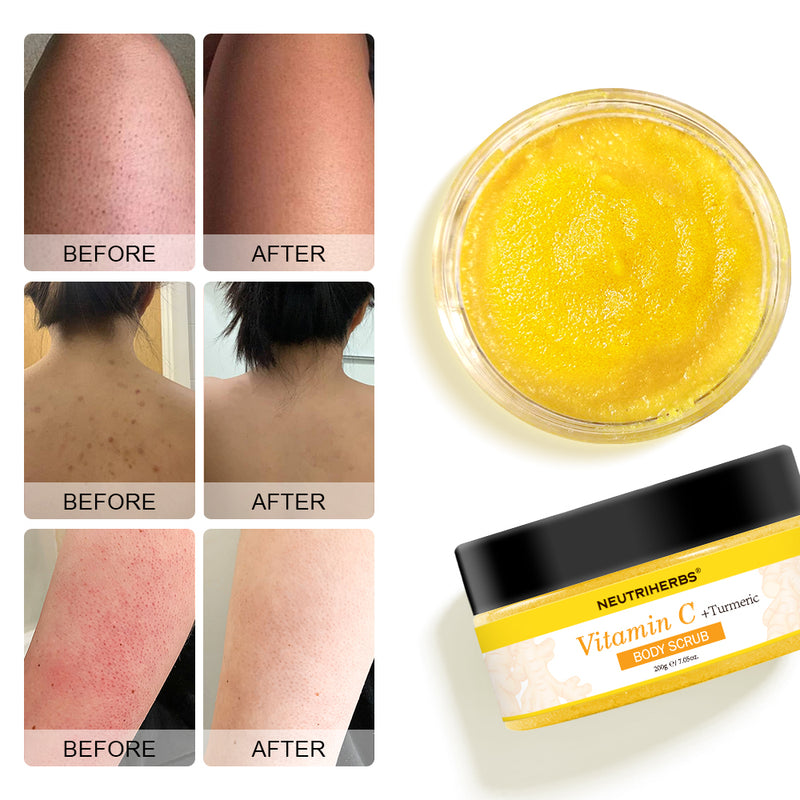 VITAMIN C & TURMERIC GLOW BODY SCRUB wil give you a very good result 