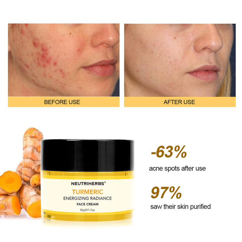 Turmeric Cream