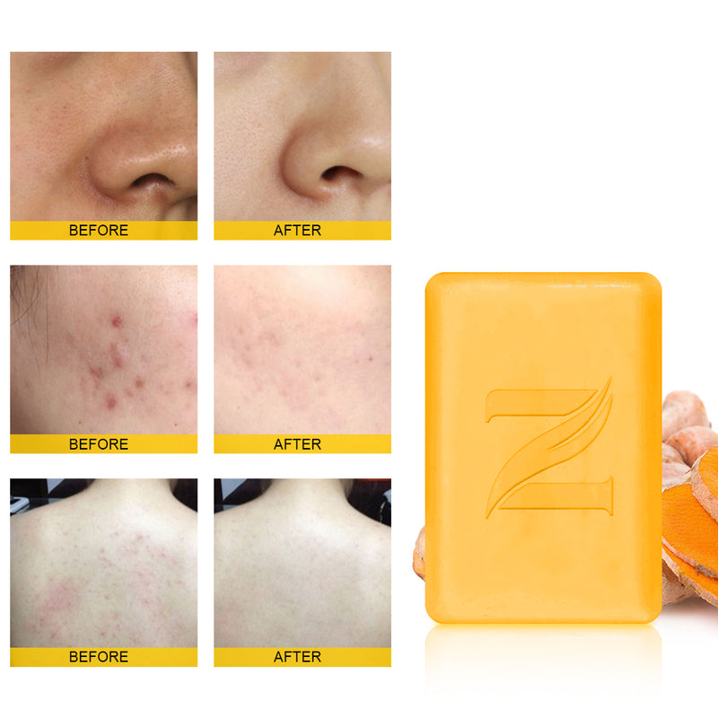 VITAMIN C & TURMERIC BRIGHTENING SOAP in good results