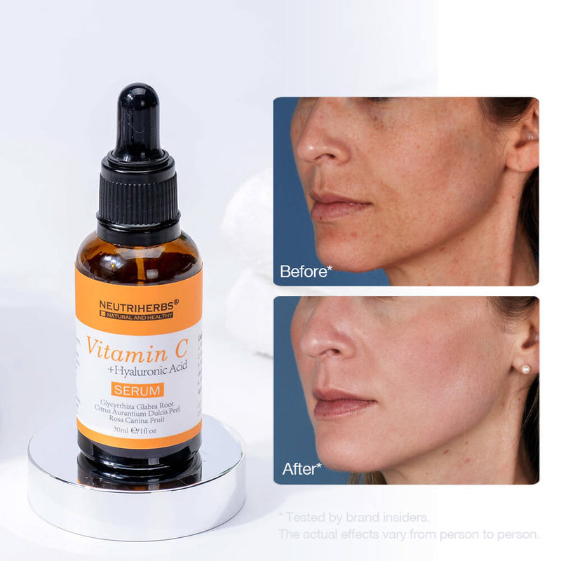 Vitamin C Serum Private Label