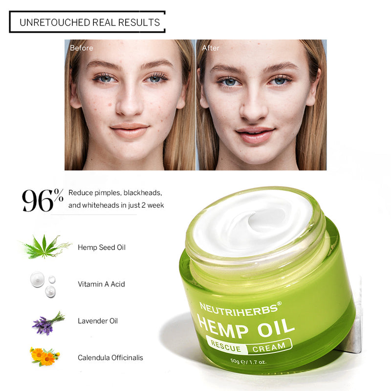  Private label acne-improving sesame oil cream