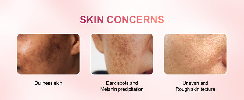 what skin type should use the kojic acid soap