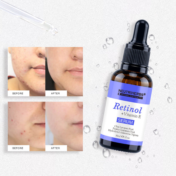 Serum Wholesale